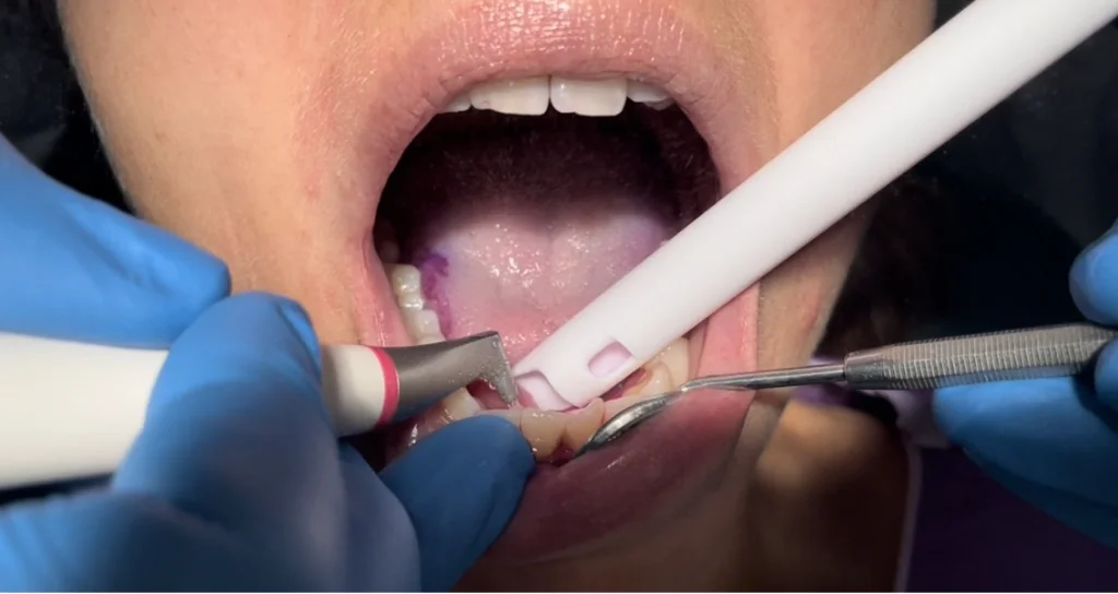 SMile Dental Hygiene-Aberdeenshire